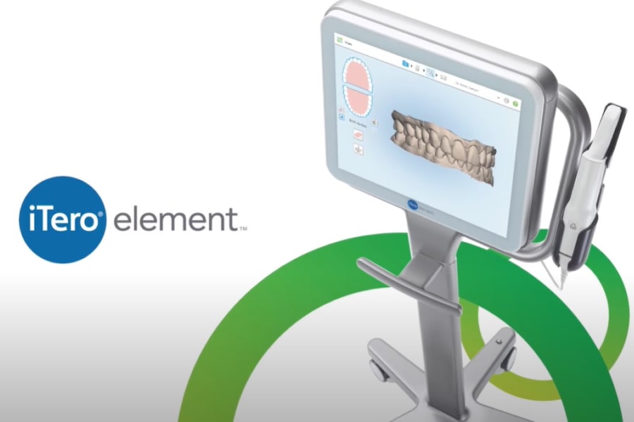 Itero scanner