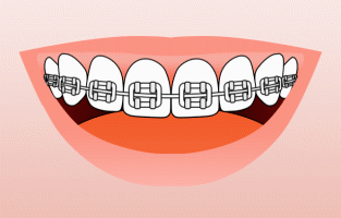 Keep Your Smile Clean and Healthy. Brushing techniques