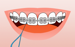 The Right Way to Care for Your Teeth. Flossing techniques