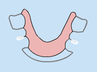 Quick Steps to Fix and Prevent Discomfort. Infographics Loose Appliance Adjustments