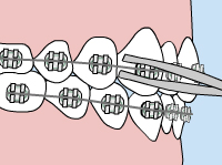 How to Handle It and Prevent Further Issues. Infographics Loose Wire Adjustments